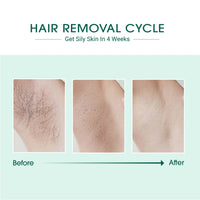 Thumbnail for Laser IPL Hair Removal