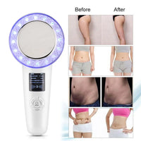 Thumbnail for 6-in-1 EMS Body Slimming Massager: RF Ultrasonic Cavitation & Anti-Cellulite Fat Burner