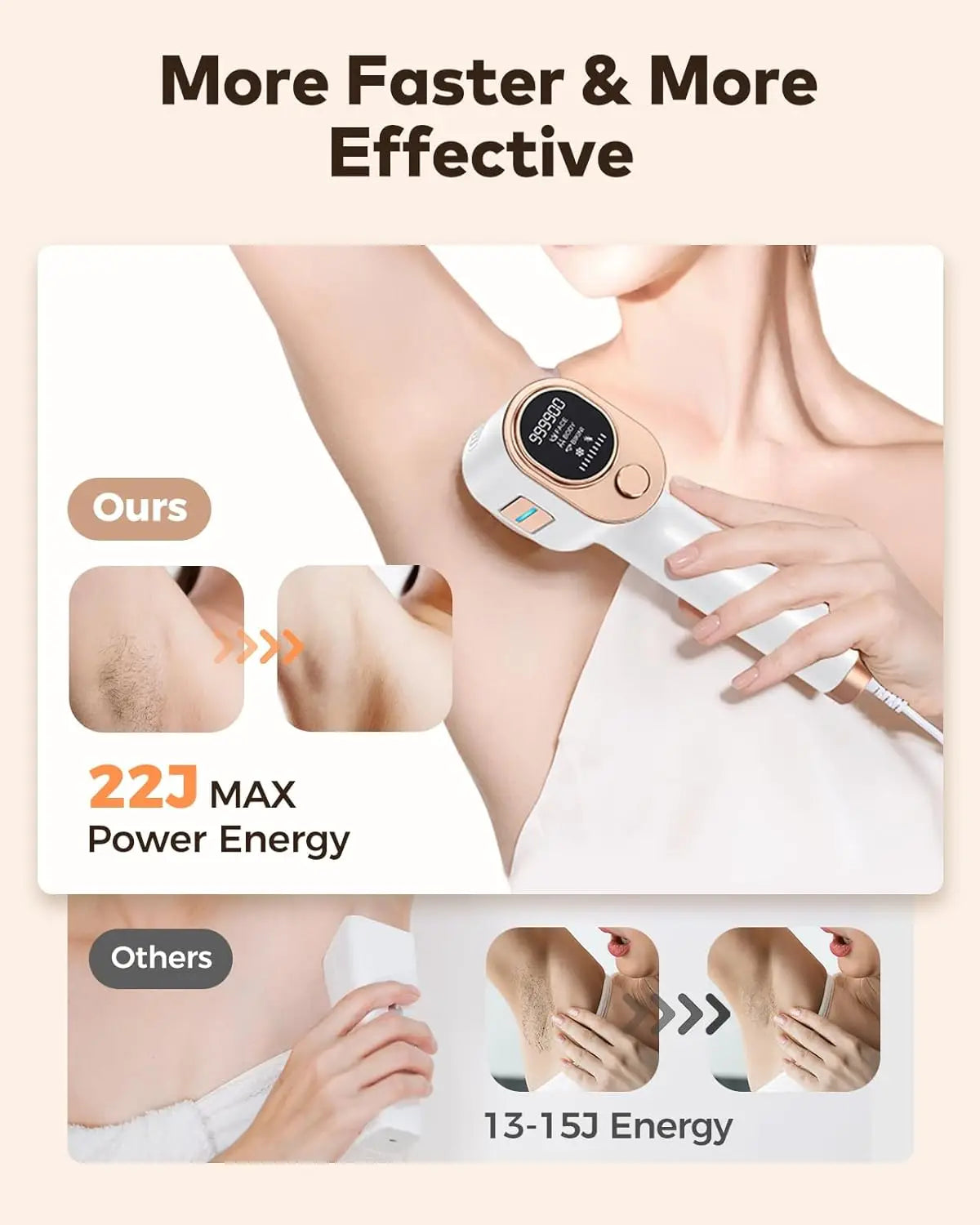 2024 IPL Laser Hair Removal